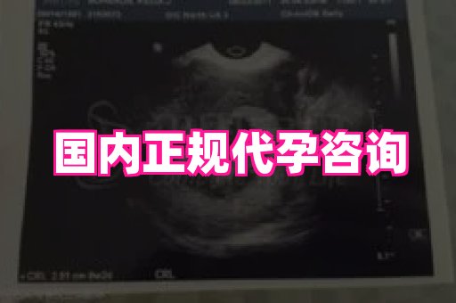 长春助孕网 4